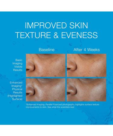 Neutrogena Hydro Boost Hyaluronic Acid Serum 1.0 oz - Transform Your Style with the Best Innovation Today! - Buy Online on GoSupps.com