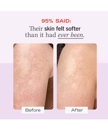 First Aid Beauty Travel Size KP Bump Eraser Body Scrub with 10% AHA Original - Transform Your Style with the Best Innovation Today! - Buy Online on GoSupps.com