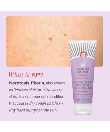First Aid Beauty Travel Size KP Bump Eraser Body Scrub with 10% AHA Original - Transform Your Style with the Best Innovation Today! - Buy Online on GoSupps.com