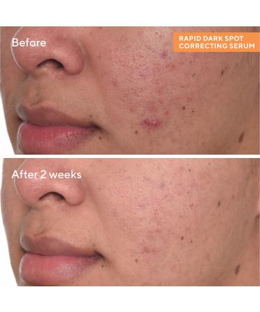 Murad Rapid Dark Spot Correcting Serum 1.0 oz - Discover Premium Quality Shop now! - Buy Online on GoSupps.com