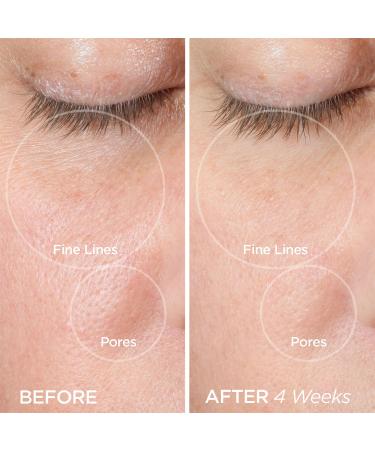 BeautyBio The ZenBubble Oil-Free Calming Gel Cream 1.7 oz - Transform Your Style with the Best Innovation Today! - Buy Online on GoSupps.com