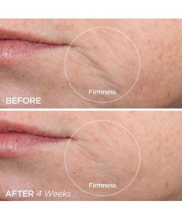 BeautyBio The ZenBubble Oil-Free Calming Gel Cream 1.7 oz - Transform Your Style with the Best Innovation Today! - Buy Online on GoSupps.com