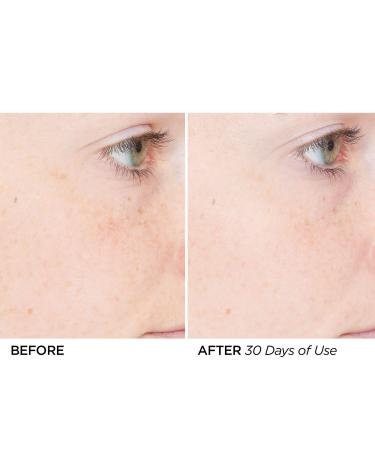 Discover BeautyBio The Nightly Retinol Repair Serum 1.0 oz - Elevate Your Style Instantly! - Buy Online on GoSupps.com