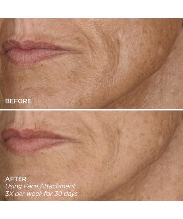 Discover BeautyBio GloPRO FACE MicroTip Attachment - Elevate Your Style Instantly! - Buy Online on GoSupps.com