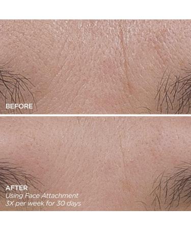 Discover BeautyBio GloPRO FACE MicroTip Attachment - Elevate Your Style Instantly! - Buy Online on GoSupps.com