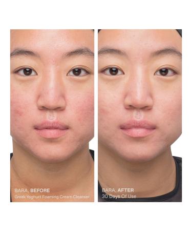 Discover KORRES Travel Size Greek Yoghurt Foaming Cream Cleanser 2.53 oz - Elevate Your Style Instantly! - Buy Online on GoSupps.com