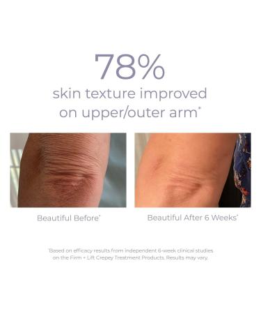 DERMA E Crepey Skin Repair Treatment with Resveratrol 6.0 oz - Discover Premium Quality Shop now! - Buy Online on GoSupps.com