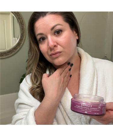 DERMA E Crepey Skin Repair Treatment with Resveratrol 6.0 oz - Discover Premium Quality Shop now! - Buy Online on GoSupps.com