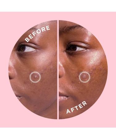 Discover ZitSticka GOO GETTER Surface Zit Hydrocolloid Patch 36 ct - Elevate Your Style Instantly! - Buy Online on GoSupps.com