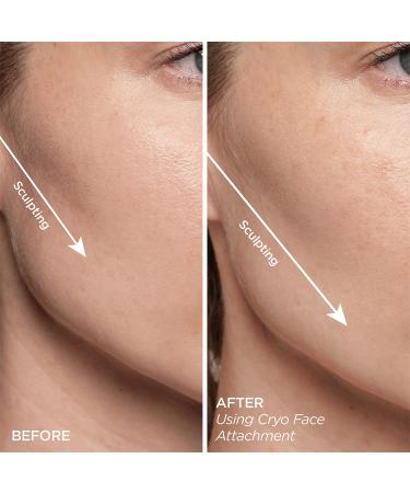 Discover BeautyBio GloPRO CRYO Roller Attachment Duo - Elevate Your Style Instantly! - Buy Online on GoSupps.com