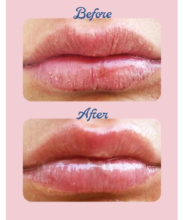 Lanolips Green Apple 101 Ointment Multi-Balm 0.35 oz - Transform Your Style with the Best Innovation Today! - Buy Online on GoSupps.com