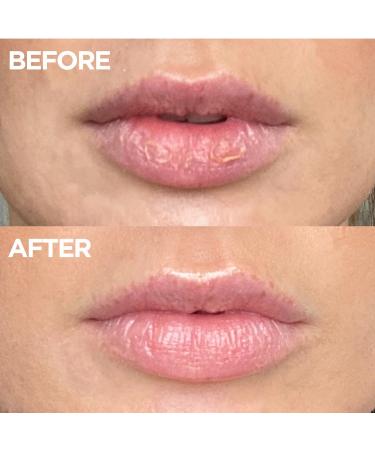 Lanolips The Original 101 Ointment Duo - Transform Your Style with the Best Innovation Today! - Buy Online on GoSupps.com