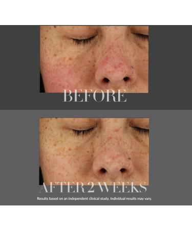 Kate Somerville KateCeuticals Total Repair Cream 1.0 oz - Transform Your Style with the Best Innovation Today! - Buy Online on GoSupps.com