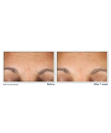 Discover RoC Multi Correxion Hydrate + Plump Hyaluronic Acid Eye Cream 0.5 oz - Elevate Your Style Instantly! - Buy Online on GoSupps.com