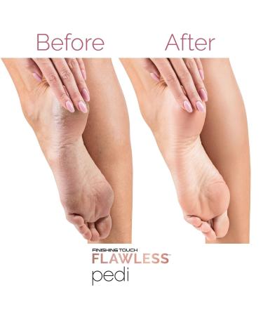 Flawless by Finishing Touch Flawless Pedi Electronic Tool File and Callus Remover - Discover Premium Quality Shop now! - Buy Online on GoSupps.com