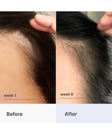 Better Not Younger Super Power Fortifying Hair & Scalp Serum Duo - Transform Your Style with the Best Innovation Today! - Buy Online on GoSupps.com