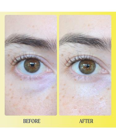 Discover Kinship Brightwave Vitamin C Energizing + Brightening Eye Cream 0.5 oz - Elevate Your Style Instantly! - Buy Online on GoSupps.com