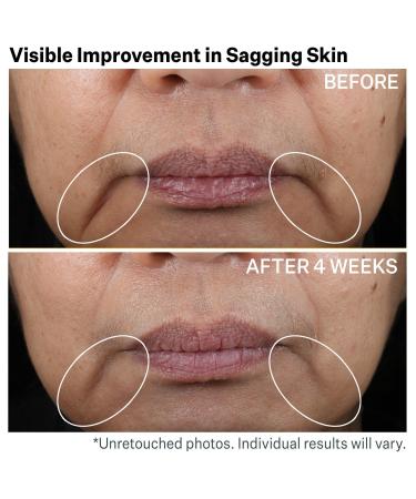 StriVectin Contour Restore Tightening & Sculpting Face Cream 1.7 oz - Transform Your Style with the Best Innovation Today! - Buy Online on GoSupps.com