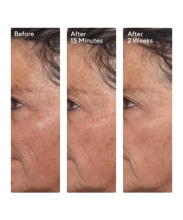 Discover Murad Targeted Wrinkle Corrector Treatment 0.5 oz - Elevate Your Style Instantly! - Buy Online on GoSupps.com