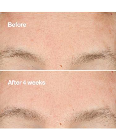 Discover Clinique Clarifying Do-Over Peel 1.0 oz - Elevate Your Style Instantly! - Buy Online on GoSupps.com