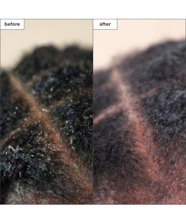 Discover Briogeo Scalp Revival Charcoal + Tea Tree Scalp Treatment Serum 1.0 oz - Elevate Your Style Instantly! - Buy Online on GoSupps.com