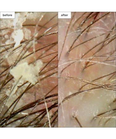 Briogeo Scalp Revival Soothe + Detoxify Travel Set 5.0 oz - Discover Premium Quality Shop now! - Buy Online on GoSupps.com