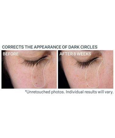 StriVectin Super-C Dark Circle Brightening Eye Serum 0.5 oz - Discover Premium Quality Shop now! - Buy Online on GoSupps.com