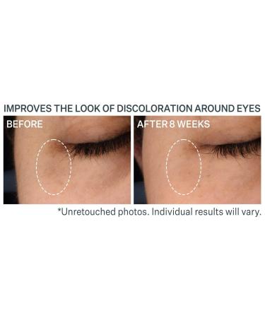 StriVectin Super-C Dark Circle Brightening Eye Serum 0.5 oz - Discover Premium Quality Shop now! - Buy Online on GoSupps.com