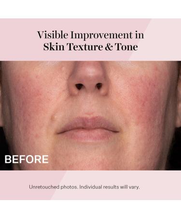 StriVectin Advanced Retinol Daily Repair Moisturizer Broad Spectrum SPF 30 1.7 oz - Transform Your Style with the Best Innovation Today! - Buy Online on GoSupps.com