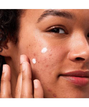 Hero Cosmetics Rescue Balm Post-Blemish Recovery Cream 0.5 oz - Transform Your Style with the Best Innovation Today! - Buy Online on GoSupps.com