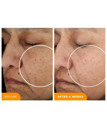 Discover BeautyStat Cosmetics Travel Size Universal C Skin Refiner 20% Vitamin C Brightening Serum 0.3 oz - Elevate Your Style Instantly! - Buy Online on GoSupps.com