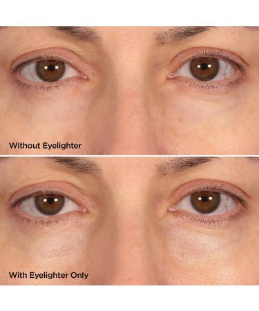 BeautyBio The Eyelighter Concentrate Serum & Depuffing Tool 0.5 oz - Discover Premium Quality Shop now! - Buy Online on GoSupps.com