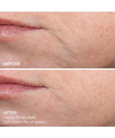 Discover BeautyBio Get That Glow GloPRO Facial Microneedling Discovery Set - Elevate Your Style Instantly! - Buy Online on GoSupps.com
