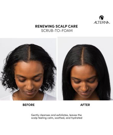 Alterna Renewing Scalp Care Scrub To Foam 6.0 oz - Transform Your Style with the Best Innovation Today! - Buy Online on GoSupps.com