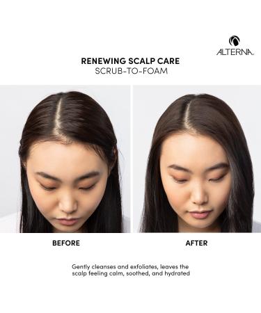 Alterna Renewing Scalp Care Scrub To Foam 6.0 oz - Transform Your Style with the Best Innovation Today! - Buy Online on GoSupps.com