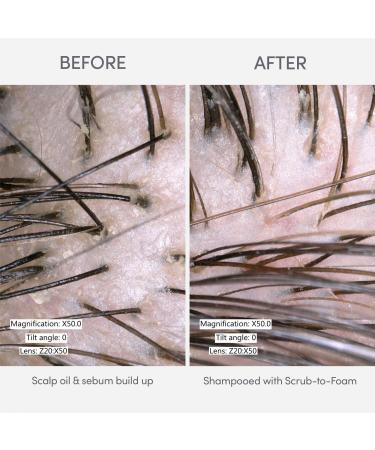 Alterna Renewing Scalp Care Scrub To Foam 6.0 oz - Transform Your Style with the Best Innovation Today! - Buy Online on GoSupps.com