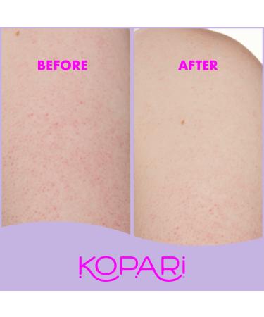 Discover Kopari Beauty KP Body Bumps Be Gone With 10% AHA 8.45 oz - Elevate Your Style Instantly! - Buy Online on GoSupps.com