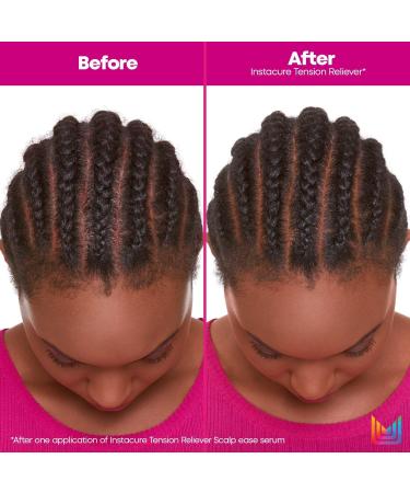 Matrix Total Results Instacure Tension Reliever Scalp Serum 6.7 oz - Transform Your Style with the Best Innovation Today! - Buy Online on GoSupps.com