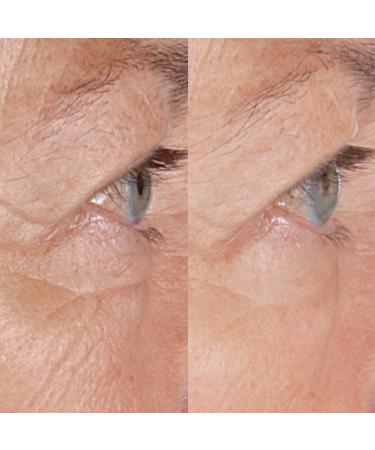 Perricone MD High Potency Hyaluronic Intensive Hydrating Serum 2.0 oz - Transform Your Style with the Best Innovation Today! - Buy Online on GoSupps.com