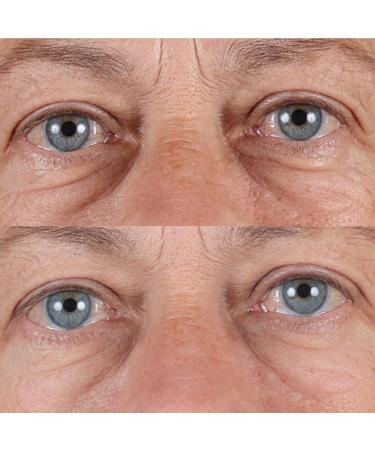 Perricone MD High Potency Hyaluronic Intensive Hydrating Serum 2.0 oz - Transform Your Style with the Best Innovation Today! - Buy Online on GoSupps.com