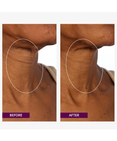 Discover Womaness Let's Neck - Neck and DÃ©colletÃ© Serum 1.7 oz - Elevate Your Style Instantly! - Buy Online on GoSupps.com