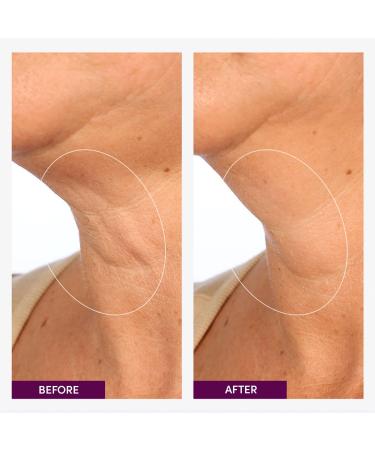 Discover Womaness Let's Neck - Neck and DÃ©colletÃ© Serum 1.7 oz - Elevate Your Style Instantly! - Buy Online on GoSupps.com