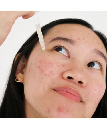 cocokind Postbiotic Acne Serum for Clear and Balanced Skin 1.0 oz - Discover Premium Quality Shop now! - Buy Online on GoSupps.com