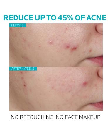 Discover La Roche-Posay Effaclar Face Serum with Salicylic Acid 1.0 oz - Elevate Your Style Instantly! - Buy Online on GoSupps.com