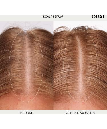 Discover OUAI Scalp Serum 2.0 oz - Elevate Your Style Instantly! - Buy Online on GoSupps.com