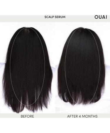 Discover OUAI Scalp Serum 2.0 oz - Elevate Your Style Instantly! - Buy Online on GoSupps.com
