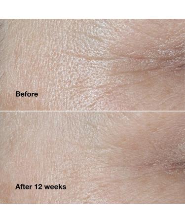 Clinique Travel Size Clinique Smart Clinical Repair Wrinkle Correcting Cream 0.5 oz - Transform Your Style with the Best Innovation Today! - Buy Online on GoSupps.com