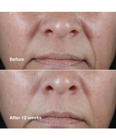 Discover Clinique Clinique Smart Clinical Repair Wrinkle Correcting Rich Face Cream 1.7 oz - Elevate Your Style Instantly! - Buy Online on GoSupps.com