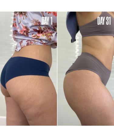 Discover MAÃ‹LYS GET-SPRUNG Enriched Stretch Mark Oil 2.0 oz - Elevate Your Style Instantly! - Buy Online on GoSupps.com