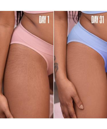 Discover MAÃ‹LYS GET-SPRUNG Enriched Stretch Mark Oil 2.0 oz - Elevate Your Style Instantly! - Buy Online on GoSupps.com